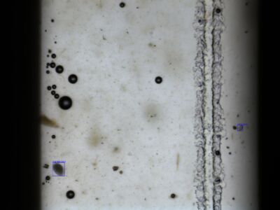 Haemonchus egg Haemonchus egg